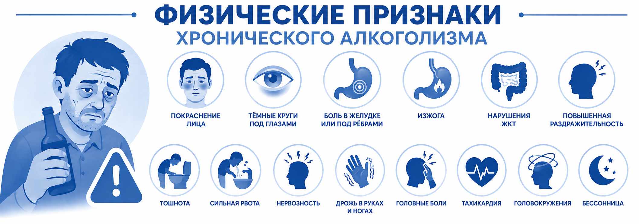 Схема с основными физическими признаками хронического алкоголизма. Показаны покраснение лица, тёмные круги под глазами, боли в желудке, изжога, нарушения работы ЖКТ, раздражительность, а также симптомы трезвого периода после запоя: тошнота, рвота, нервозность, дрожь, головные боли, тахикардия, головокружение и бессонница.